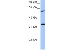 WB Suggested Anti-TSKS Antibody Titration: 0. (TSKS 抗体  (Middle Region))