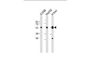 All lanes : Anti-UGP2 Antibody (C-term) at 1:2000 dilution Lane 1:  whole cell lysate Lane 2: HepG2 whole cell lysate Lane 3: Human liver lysate Lysates/proteins at 20 μg per lane. (UGP2 抗体  (C-Term))