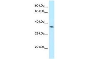 Image no. 1 for anti-Aminolevulinate Dehydratase (ALAD) (N-Term) antibody (ABIN6747869) (ALAD 抗体  (N-Term))