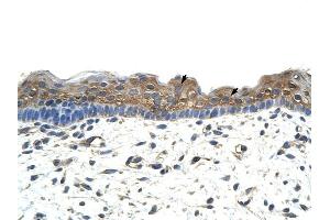 ApoBEC2 antibody was used for immunohistochemistry at a concentration of 4-8 ug/ml to stain Squamous epithelial cells (arrows) in Human Skin. (APOBEC2 抗体  (N-Term))