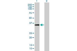 Western Blot analysis of AKTIP expression in transfected 293T cell line by AKTIP MaxPab polyclonal antibody. (AKTIP 抗体  (AA 1-292))