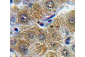 Used in DAB staining on fromalin fixed paraffin-embedded Liver tissue (ORM1 抗体  (AA 19-201))