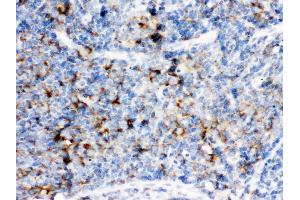 Immunohistochemistry (Paraffin-embedded Sections) (IHC (p)) image for anti-CD14 (CD14) (AA 65-327) antibody (ABIN3044565)