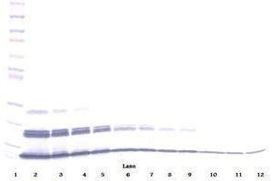 Image no. 3 for anti-Chemokine (C-X-C Motif) Ligand 16 (CXCL16) antibody (ABIN465413) (CXCL16 抗体)