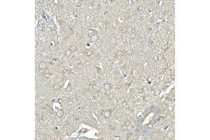 Immunohistochemistry of paraffin-embedded mouse spinal cord using IL11RA Rabbit mAb (ABIN7267984) at dilution of 1:150 (40x lens). (IL11RA 抗体)