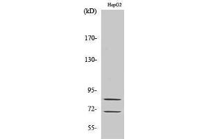 Western Blotting (WB) image for anti-Choline O-Acetyltransferase (CHAT) (Internal Region) antibody (ABIN3183908) (Choline Acetyltransferase 抗体  (Internal Region))