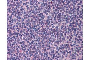 Immunohistochemistry (IHC) image for anti-Promyelocytic Leukemia (PML) (C-Term) antibody (ABIN2777721) (PML 抗体  (C-Term))