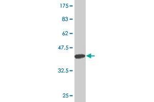 Western Blot detection against Immunogen (37. (ARHGAP6 抗体  (AA 531-636))