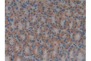 Used in DAB staining on fromalin fixed paraffin- embedded kidney tissue (HMGB1 抗体  (AA 1-215))