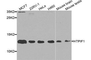 Western blot analysis of extract of various cells, using ATPIF1 antibody. (ATPase Inhibitory Factor 1 抗体)