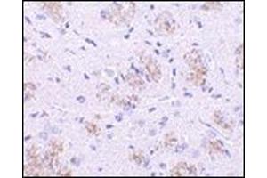 Immunohistochemistry of KLHL1 in rat brain tissue with this product at 10 μg/ml. (KLHL1 抗体  (N-Term))