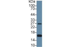 Detection of AQP2 in Human Hela cell lysate using Polyclonal Antibody to Aquaporin 2, Collecting Duct (AQP2) (AQP2 抗体  (AA 177-271))