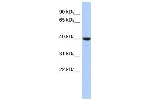 GLRX3 antibody used at 1 ug/ml to detect target protein. (GLRX3 抗体  (N-Term))