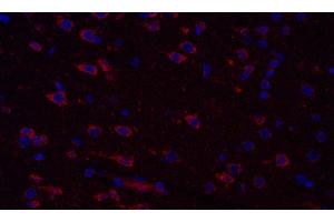 Immunofluorescence analysis of paraffin-embedded Rat brain using COX4I1 Polyclonal Antibody at dilution of 1:300. (COX IV 抗体)
