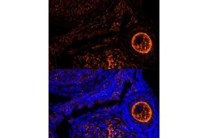 Immunofluorescence analysis of mouse oophoroma cells using ZP2 antibody (ABIN6128965, ABIN6150534, ABIN6150535 and ABIN6214263) at dilution of 1:100. (ZP2 抗体  (AA 651-745))