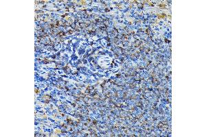 Immunohistochemistry of paraffin-embedded mouse spleen using RPL23A Rabbit pAb (ABIN1682576, ABIN3018519, ABIN3018520 and ABIN6220494) at dilution of 1:100 (40x lens). (RPL23A 抗体  (AA 1-156))