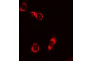 ABIN6267680 staining 293 cells by IF/ICC. (BAD 抗体  (pSer155))