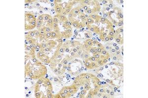 Immunohistochemistry of paraffin-embedded mouse kidney using CCDC124 antibody  at dilution of 1:100 (40x lens). (CCDC124 抗体  (AA 1-223))