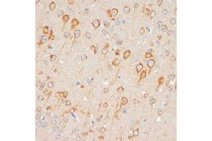 Immunohistochemistry (IHC) image for anti-Glutamate Receptor 1 (GLUR1) (AA 19-300) antibody (ABIN3015589)