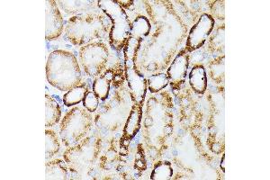 Immunohistochemistry (IHC) image for anti-Mitochondrially Encoded NADH Dehydrogenase 5 (MT-ND5) (C-Term) antibody (ABIN7268603)