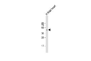 Anti-ZDHHC18 Antibody (C-Term) at 1:1000 dilution + human fetal heart lysate Lysates/proteins at 20 μg per lane. (ZDHHC18 抗体  (AA 331-361))