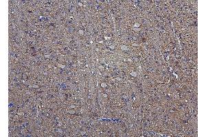 IHC analysis of Hexokinase 1/HK1 using anti-Hexokinase 1/HK1 antibody (ABIN7600260).