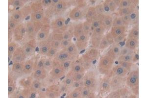Detection of AFP in Human Liver Tissue using Polyclonal Antibody to Alpha-Fetoprotein (AFP) (alpha Fetoprotein 抗体  (AA 31-171))
