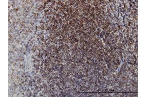 Immunoperoxidase of monoclonal antibody to EPHB3 on formalin-fixed paraffin-embedded human tonsil. (EPH Receptor B3 抗体  (AA 899-997))