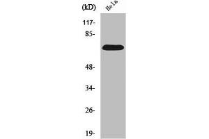 Western Blot analysis of HepG2 cells using SDHA Polyclonal Antibody (SDHA 抗体  (C-Term))