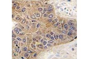 Immunohistochemistry (IHC) image for anti-STIP1 Homology and U-Box Containing Protein 1 (STUB1) (AA 203-231) antibody (ABIN3032755)