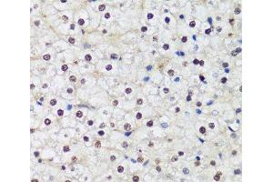Immunohistochemistry of paraffin-embedded Human liver using DNMT1 Polyclonal Antibody at dilution of 1:200 (40x lens). (DNMT1 抗体)