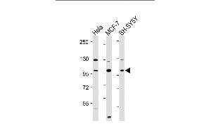 All lanes : Anti-VAV2 Antibody (N-Term) at 1:2000 dilution Lane 1: Hela whole cell lysate Lane 2: MCF-7 whole cell lysate Lane 3: SH-SY5Y whole cell lysate Lysates/proteins at 20 μg per lane. (VAV2 抗体)
