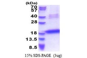 SDS-PAGE (SDS) image for Leukocyte Cell Derived Chemotaxin 1 (LECT1) (AA 214-334) protein (His tag) (ABIN5853498) (LECT1 Protein (AA 214-334) (His tag))