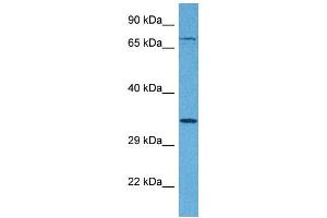 Host:  Rabbit  Target Name:  TSPAN5  Sample Tissue:  Human 293T Whole Cell  Antibody Dilution:  1ug/ml (Tetraspanin 5 抗体  (Middle Region))