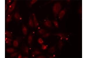 Immunofluorescence analysis of U2OS cells using PCCB antibody (ABIN5973142). (PCCB 抗体)