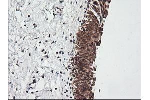 Image no. 3 for anti-RIO Kinase 2 (RIOK2) (AA 277-552) antibody (ABIN1491305)