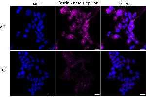 Immunocytochemical staining of HeLa cells using Casein kinase 1 epsilon antibody (ABIN7797881), 1:1,000), Top panel: wild-type (WT), Bottom panal: Casein kinase 1 epsilon shRNA knockdown (KD). (CK1 epsilon 抗体)