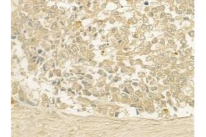 ABIN6257620 and ABIN6275306 at 1/100 staining human normal gastric tissue by IHC-P. (NEGR1 抗体  (Internal Region))
