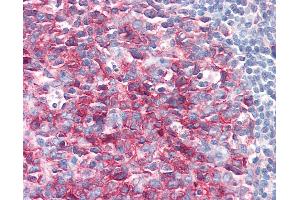 Anti-PAG1 / PAG antibody IHC of human tonsil. (PAG1 抗体  (AA 97-432))