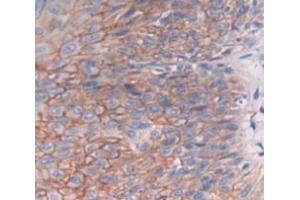 Used in DAB staining on fromalin fixed paraffin- embedded skin cancer tissue (DHODH 抗体  (AA 35-392))