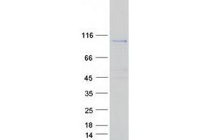 Western Blotting (WB) image for Pleckstrin Homology Domain Containing, Family G (With RhoGef Domain) Member 6 (PLEKHG6) (Transcript Variant 3) protein (Myc-DYKDDDDK Tag) (ABIN2726699)