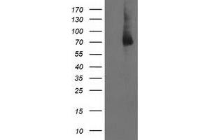 Western Blotting (WB) image for anti-LIM Domain Kinase 1 (LIMK1) antibody (ABIN1499145) (LIM Domain Kinase 1 抗体)
