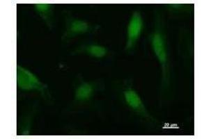 Immunostaining analysis in HeLa cells. (AHNAK 抗体)