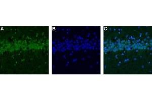 Expression of CALHM1 in rat hippocampus - Immunohistochemical staining of rat hippocampus using Anti-CALHM1 Antibody (ABIN7043013, ABIN7044044 and ABIN7044045). (CALHM1 抗体  (C-Term, Intracellular))