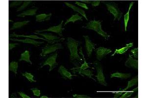 Immunofluorescence of monoclonal antibody to HTT on HeLa cell. (Huntingtin 抗体  (AA 1524-1627))