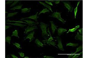 Immunofluorescence of monoclonal antibody to HTT on HeLa cell. (Huntingtin 抗体  (AA 1524-1627))