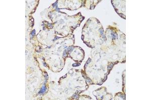 Immunohistochemistry of paraffin-embedded human placenta using ECH1 antibody  at dilution of 1:150 (40x lens). (ECH1 抗体  (AA 1-328))