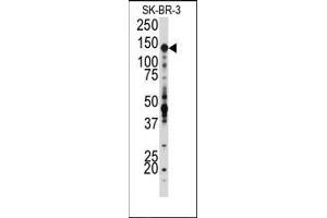 Western blot analysis of anti-IGF1R Antibody (N-term) in SK-BR-3 cell line lysates (35ug/lane). (IGF1R 抗体  (N-Term))