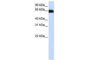 ADAM12 antibody used at 1 ug/ml to detect target protein. (ADAM12 抗体)