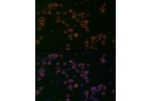 Immunofluorescence analysis of Jurkat cells using CD99 Rabbit pAb (ABIN3022730, ABIN3022731, ABIN3022732, ABIN1512728 and ABIN6219199) at dilution of 1:25 (40x lens). (CD99 抗体  (AA 23-185))